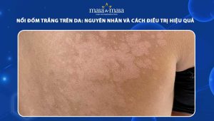 nổi đốm trắng trên da