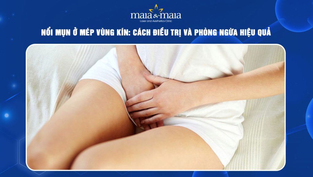 Nổi mụn ở mép vùng kín: Cách điều trị và phòng ngừa hiệu quả 1 Nổi mụn ở mép vùng kín