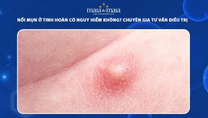 nổi mụn ở tinh hoàn