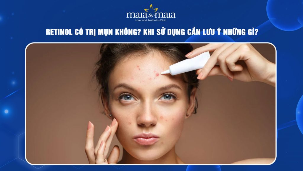 Retinol có trị mụn không? Khi sử dụng cần lưu ý những gì? 1 Retinol có trị mụn không