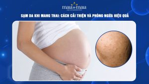 Sạm da khi mang thai