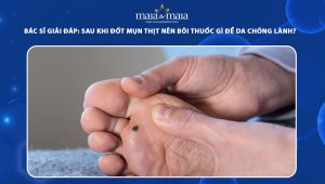 sau khi đốt mụn thịt nên bôi thuốc gì