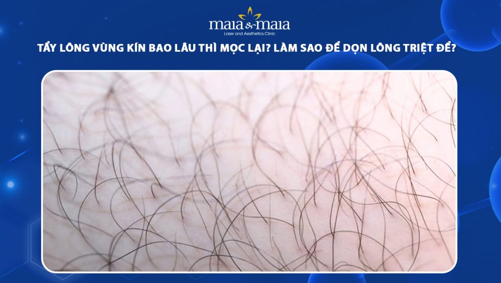 tẩy lông vùng kín bao lâu thì mọc lại