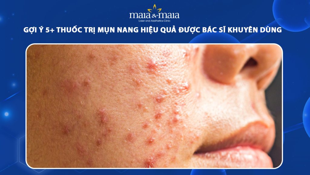 thuốc trị mụn nang