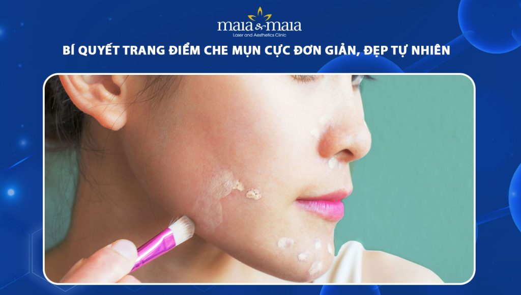 Bí quyết trang điểm che mụn cực đơn giản, đẹp tự nhiên 1 trang điểm che mụn
