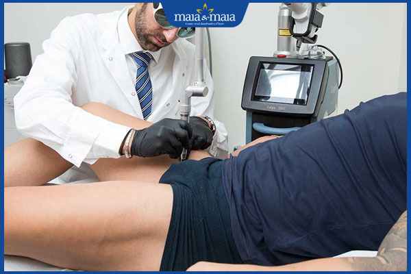 trị hạt fordyce bằng laser