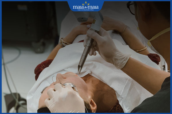 Mụn nội tiết ở quai hàm: Nguyên nhân, cách điều trị dứt điểm 4 trị mụn nội tiết ở cằm bằng công nghệ cao