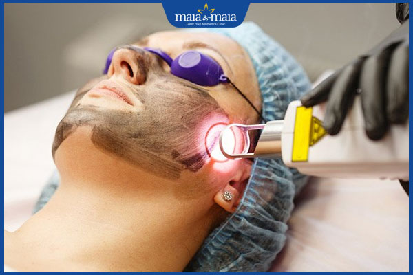 trị nám cấp tốc