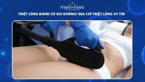 triệt lông bikini có xui không