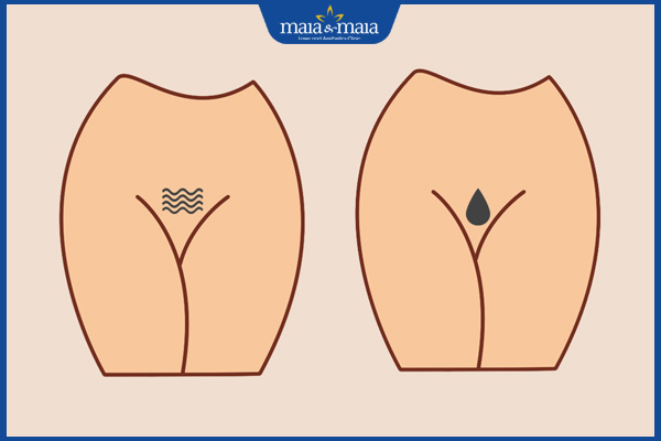 Tạo hình bikini phong thủy theo ngũ hành mang vận khí tốt 3 triệt lông bikini mệnh thủy