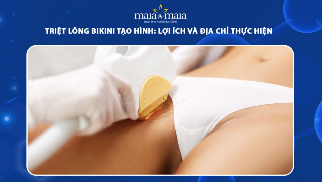 Triệt lông bikini tạo hình: Lợi ích và địa chỉ thực hiện 1 triệt lông bikini tạo hình