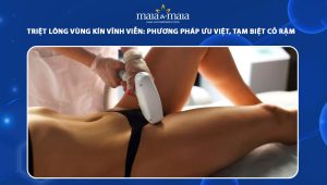 triệt lông vùng kín vĩnh viễn