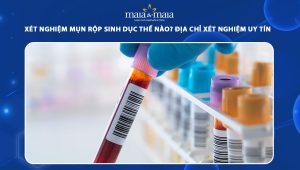 xét nghiệm mụn rộp sinh dục