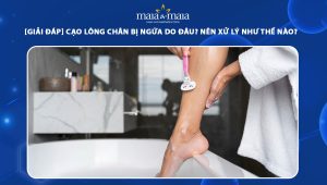 cạo lông chân bị ngứa