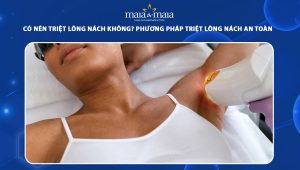 có nên triệt lông nách không