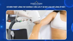 có nên triệt lông tay không