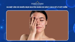 da mặt sần sùi nhiều mụn