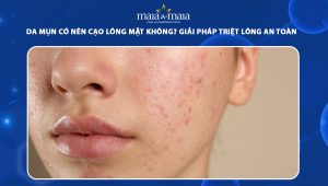 da mụn có nên cạo lông mặt không