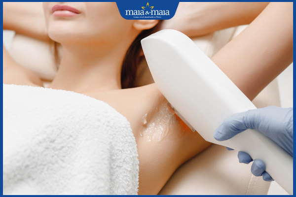 ipl triệt lông nách