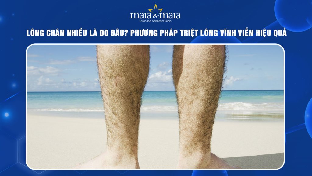 Lông chân nhiều là do đâu? Phương pháp triệt lông vĩnh viễn 1 lông chân nhiều