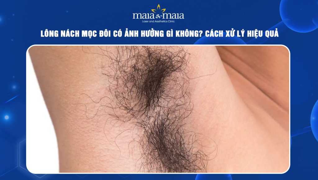 Lông nách mọc đôi