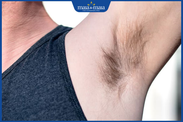 Đàn ông có nên cạo lông nách không? Giải pháp dọn lông nách vĩnh viễn 2 lông nách ở nam giới