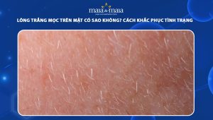 lông trắng mọc trên mặt