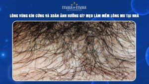 Lông vùng kín cứng và xoăn