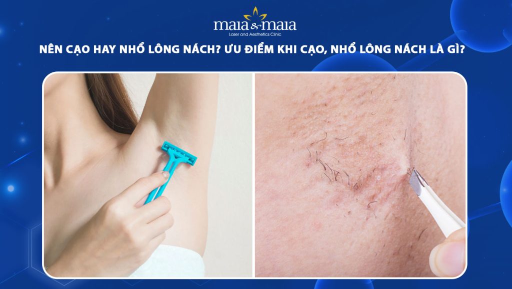 nên cạo hay nhổ lông nách
