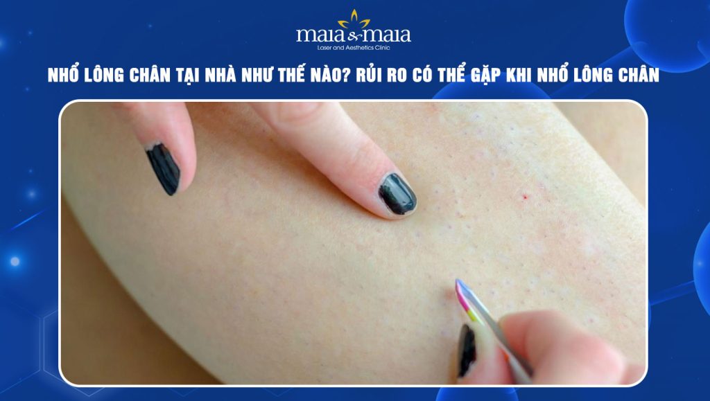 Nhổ lông chân tại nhà như thế nào? Rủi ro có thể gặp 1 Nhổ lông chân