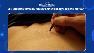 nhổ lông vùng kín