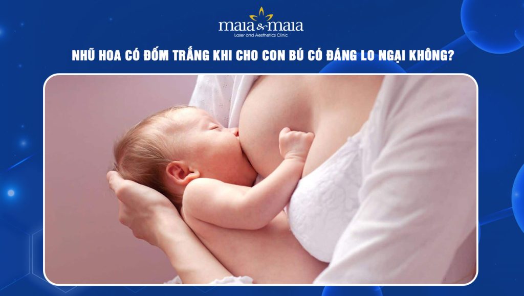 Nhũ hoa có đốm trắng khi cho con bú