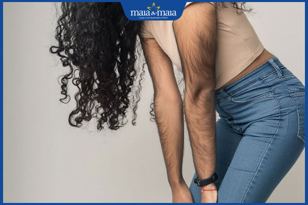 phụ nữ nhiều lông tay