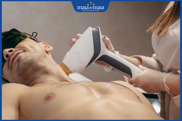 quy trình triệt lông cho nam giới