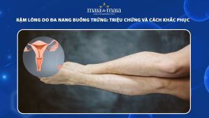 rậm lông do đa nang buồng trứng