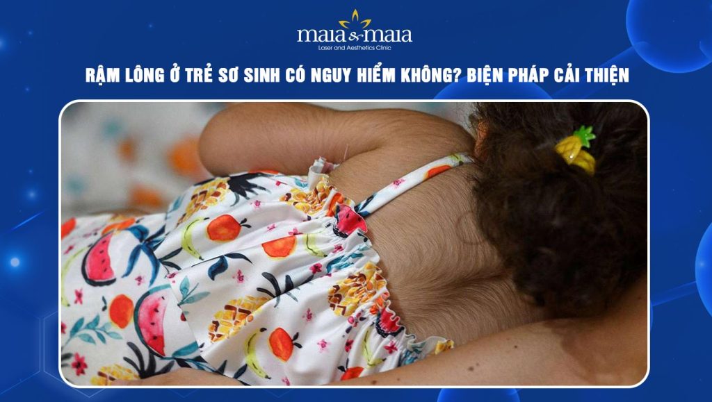 Rậm lông ở trẻ sơ sinh