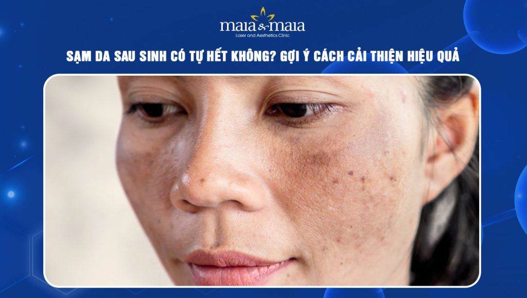 Sạm da sau sinh có tự hết không? Cách cải thiện hiệu quả 1 Sạm da sau sinh