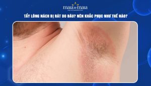 tẩy lông nách bị rát