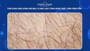 thời gian lông vùng kín mọc lại