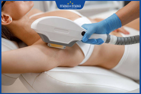 thực hiện triệt lông nách