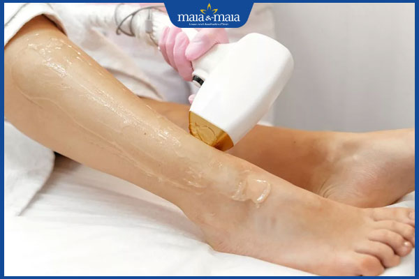 Triệt lông 1/2 chân là gì? Thực hiện ra sao? Giá bao nhiêu? 2 thực hiện triệt lông nửa chân