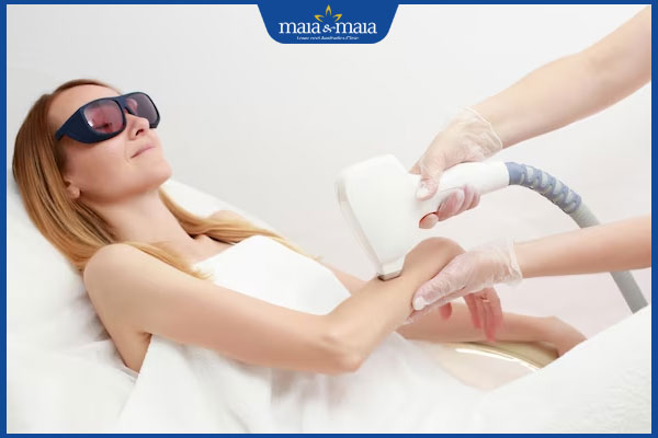 thực hiện triệt lông tay