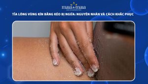 tỉa lông vùng kín bằng kéo bị ngứa