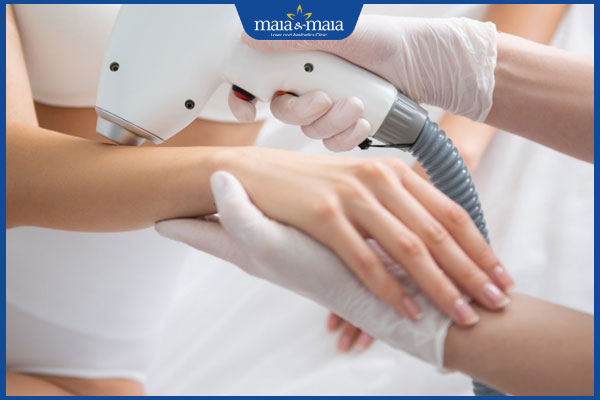 Điểm danh các cách triệt lông ngón tay an toàn tại nhà 5 tiến hành triệt lông tay