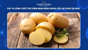 trị thâm mụn bằng khoai tây