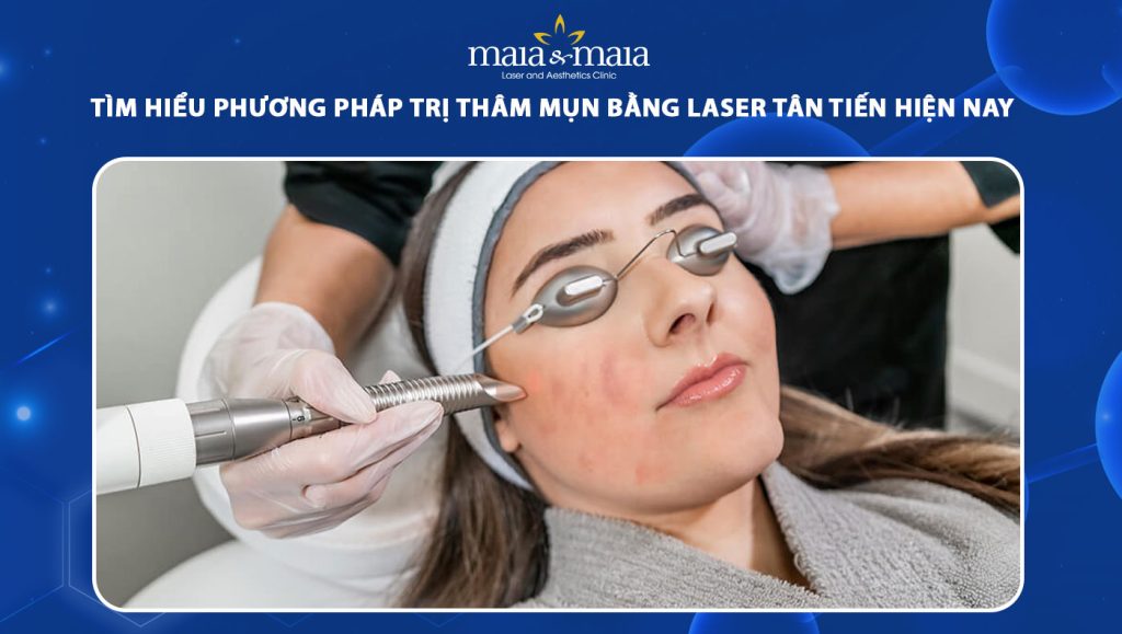 Trị thâm mụn bằng laser: Quy trình và chi phí thực hiện 1 trị thâm mụn bằng laser
