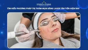 trị thâm mụn bằng laser
