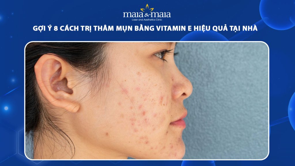 trị thâm mụn bằng vitamin e