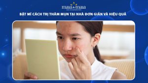 trị thâm mụn tại nhà