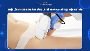 Triệt lông bikini bằng ánh sáng